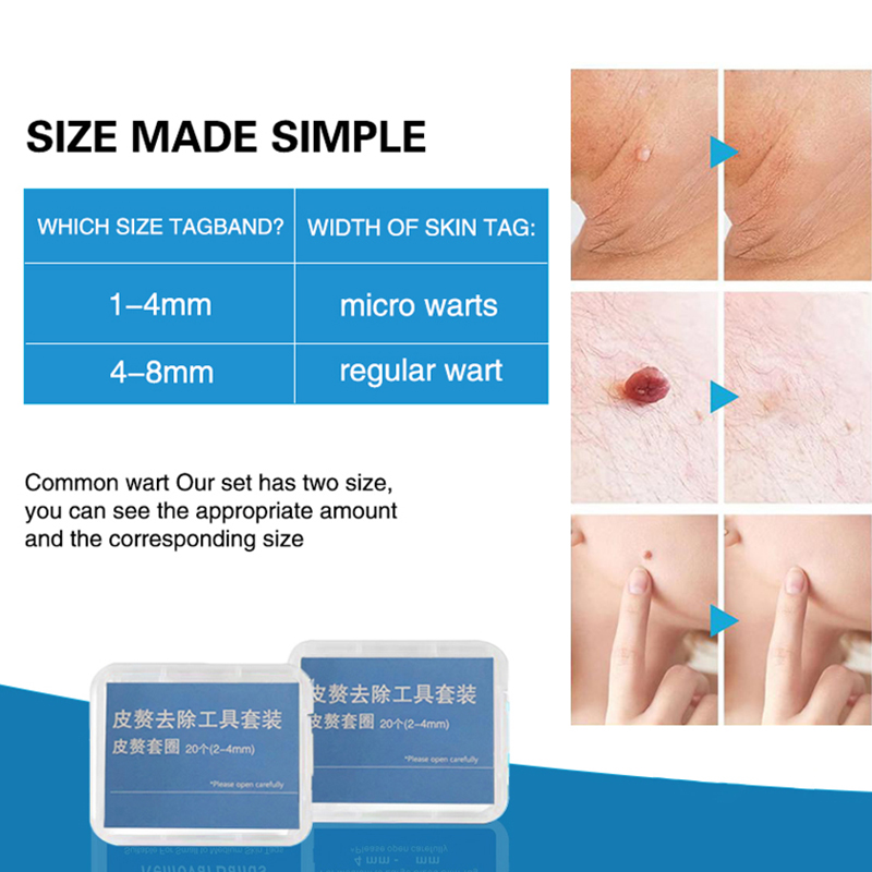 20pcs/Box Flesh Nevus Removal  - Candle Shop review and price